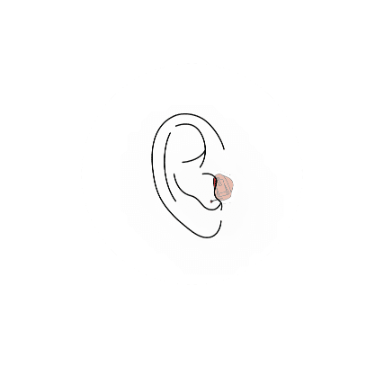 CIC hearing aid illustration